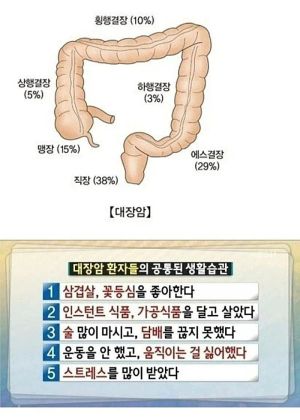 의외로 대장암 환자들에게서 자주 보이는 습관들